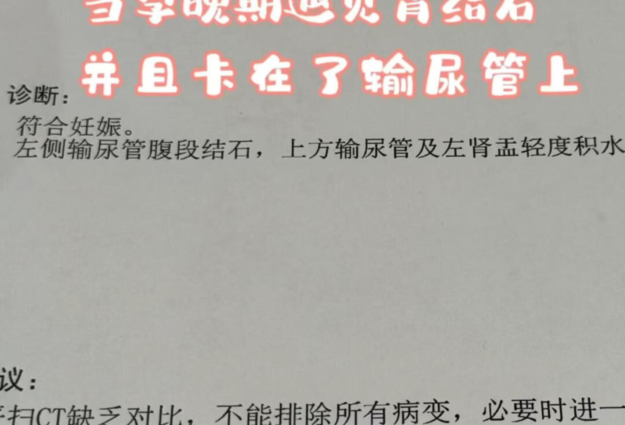 当孕晚期遇见肾结石，并且卡在了输尿管上