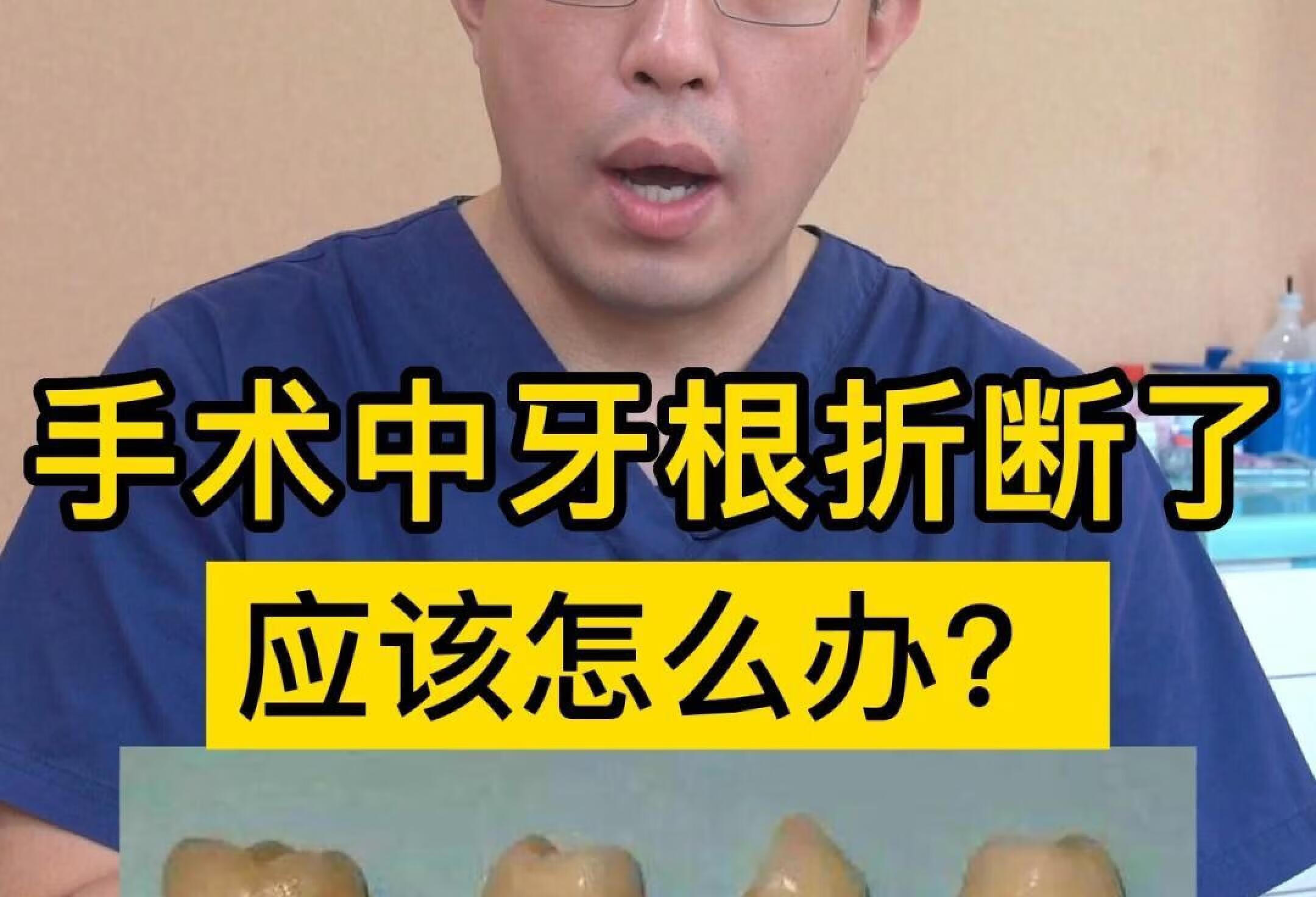 医生在拔牙过程中牙根断了会如何处理？