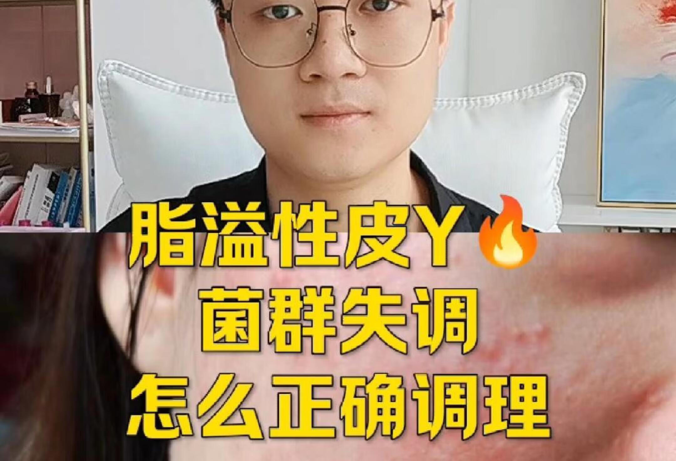 脂溢性皮炎菌群失调，怎么正确调理？