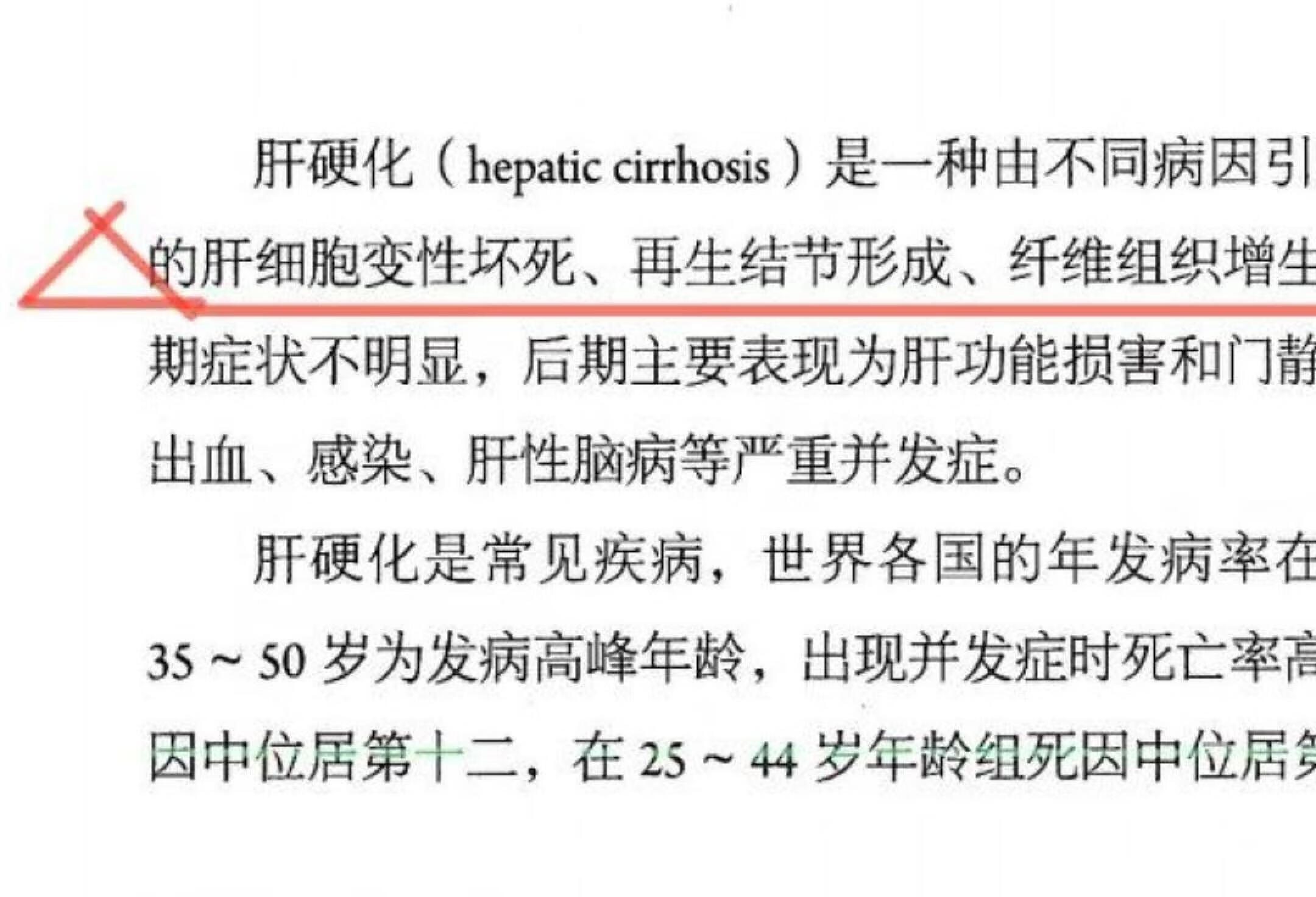 外科护理学|肝性脑病和肝硬化