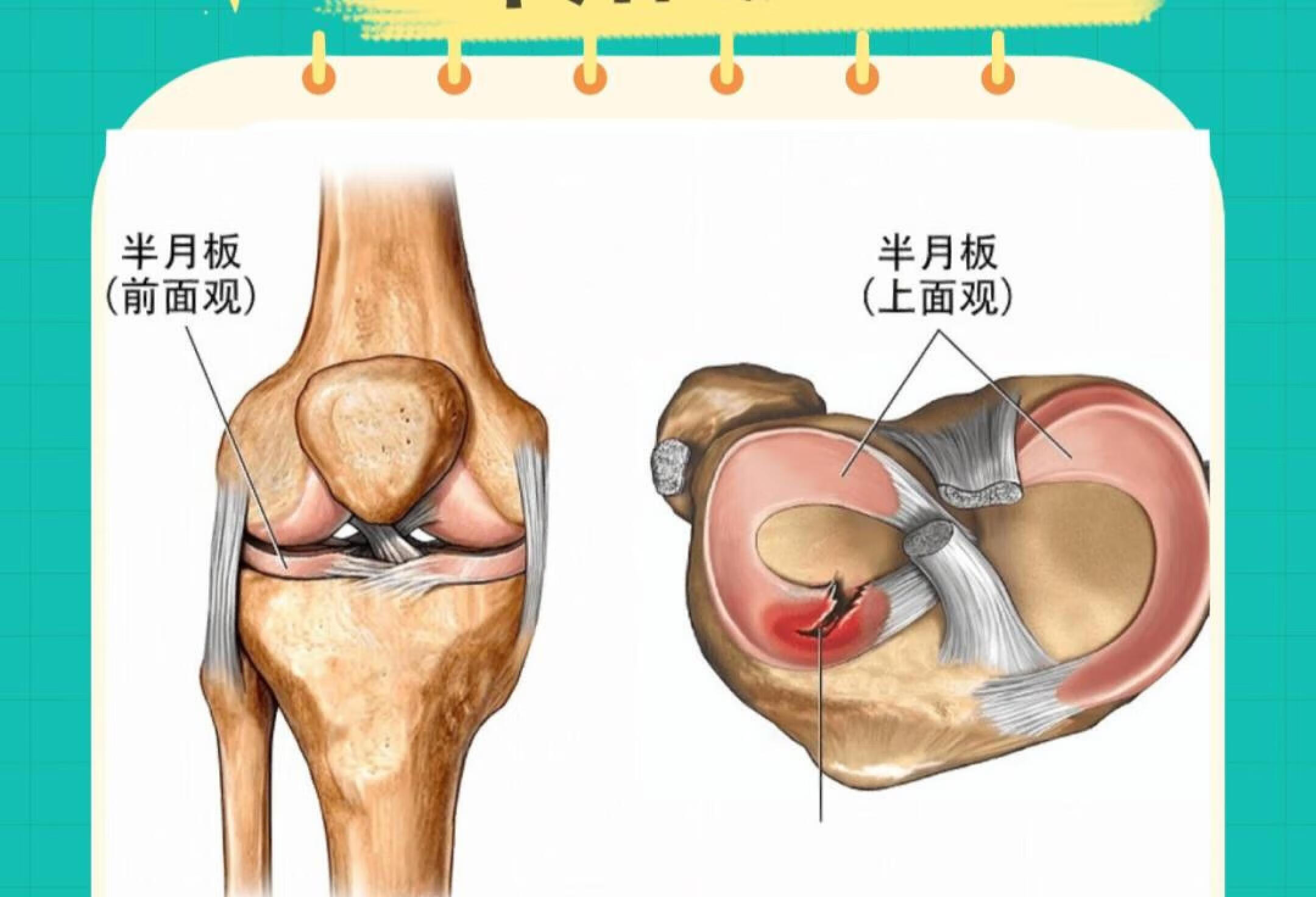 膝关节疼痛 半月板损伤 你的人生还没完