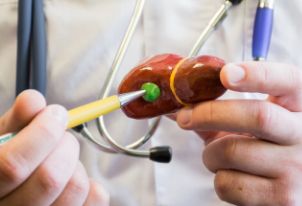 胆囊息肉如何检查？