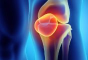 运动爱好者如何早期规范诊治膝关节半月板损伤