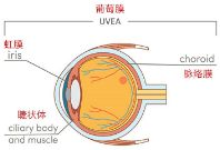 “眼红”就是红眼病？别自己诊断！