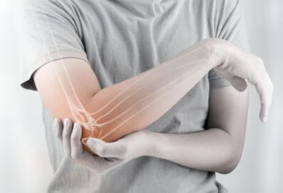 创伤性肘关节炎的康复治疗