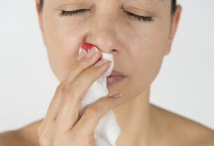 鼻出血你会正确处理吗？