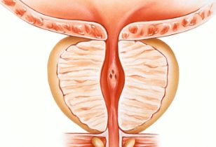 前列腺切除有什么危害吗？