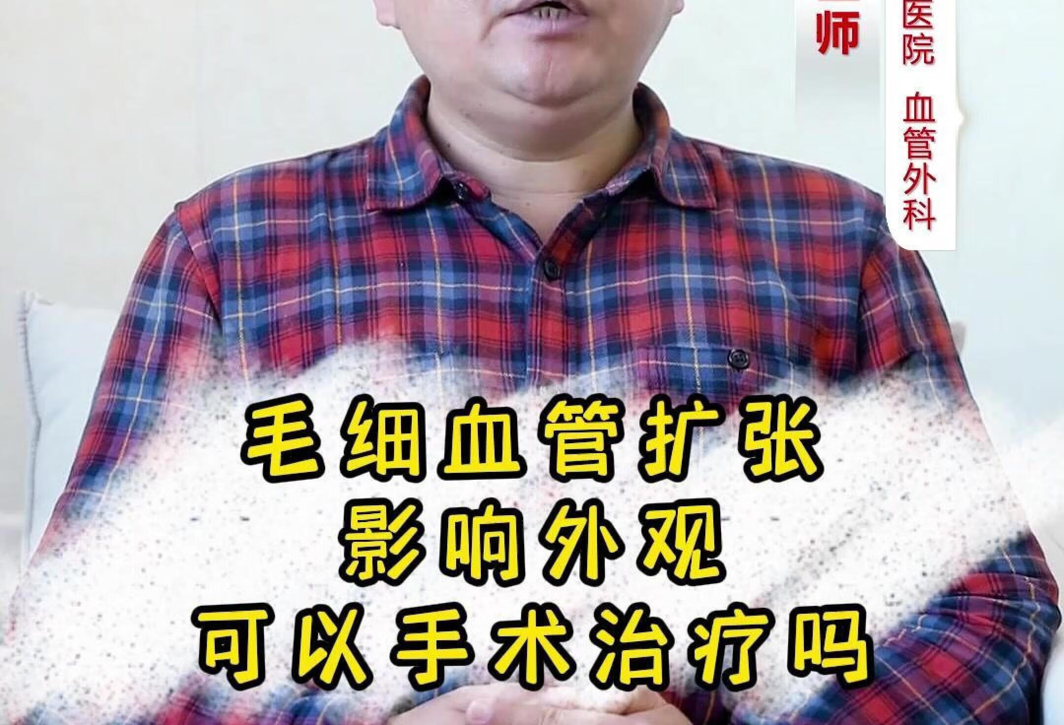 毛细血管扩张影响外观，可以手术治疗吗？