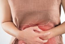 什么是功能性胃肠病？