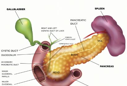 胰腺癌容易与哪些疾病相互混淆？