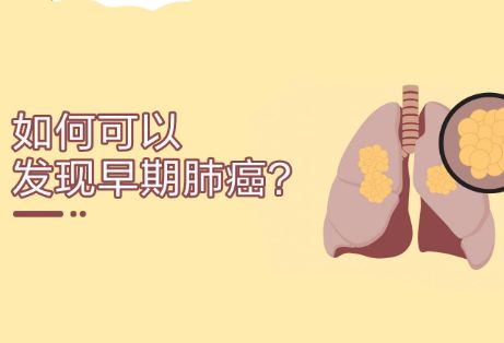 如何可以发现早期肺癌？