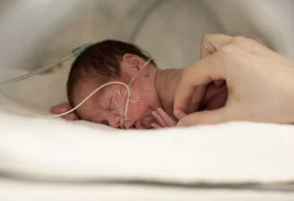 早产儿呼吸中枢发育未成熟