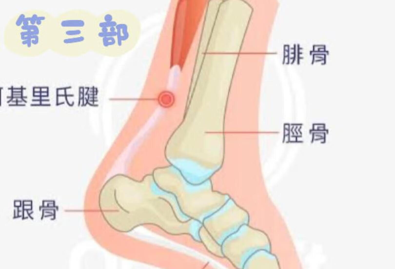 足跟疼跟腱炎的康复训练｜进阶训练之三