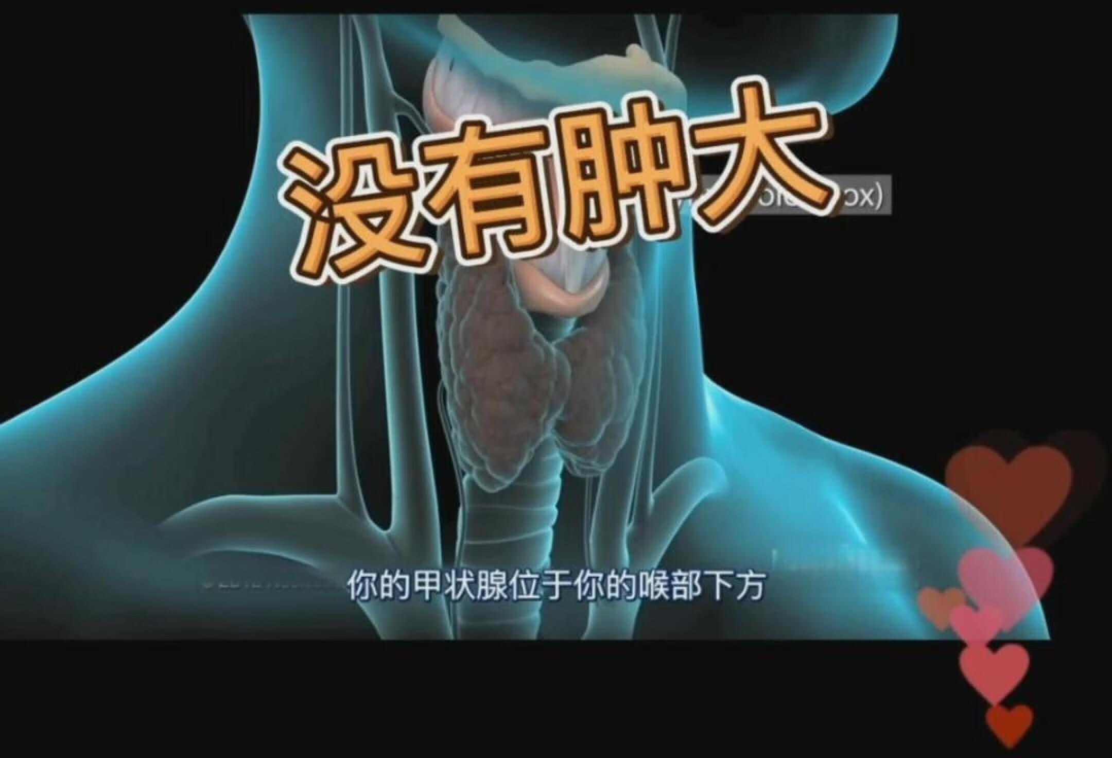 只要甲状腺没有肿大就没有甲状腺疾病吗？