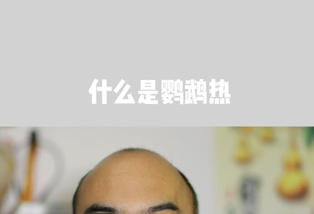 什么是鹦鹉热？