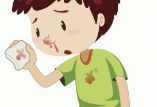 鼻出血的家庭处理方法有哪些