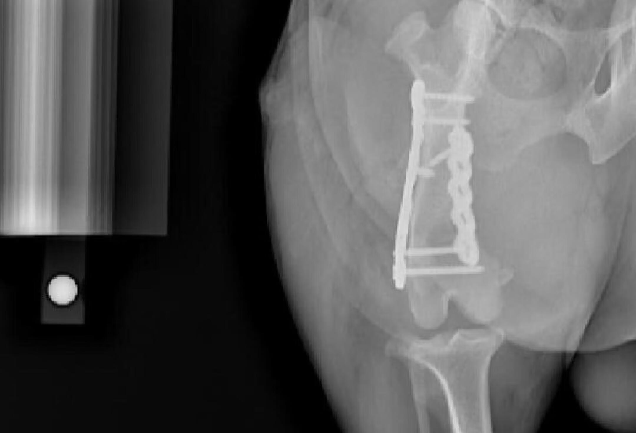 犬股骨远端骨折内固定治疗