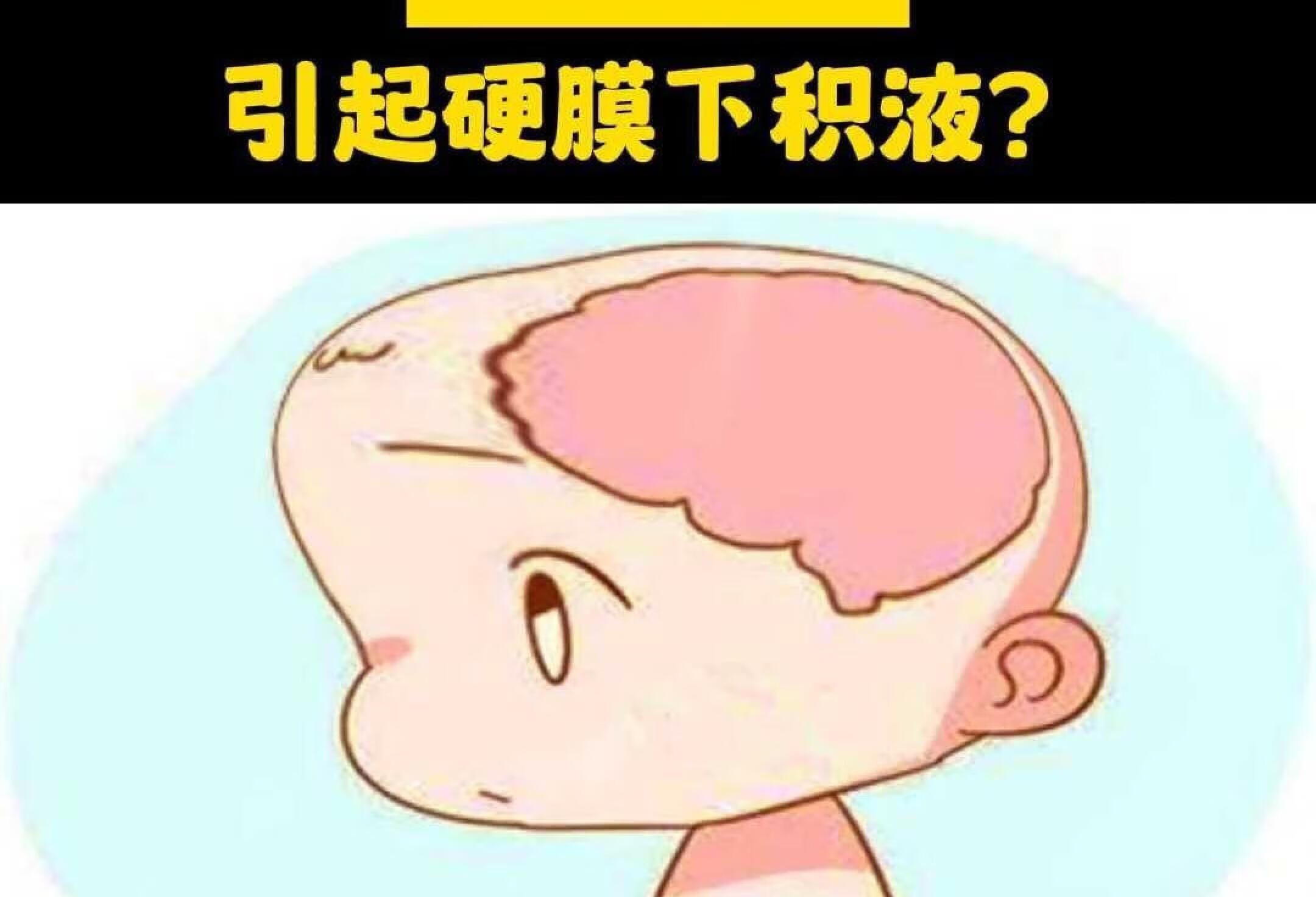 孩子摔倒引起硬模下积液？