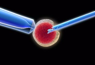 人工卵母细胞激活在ICSI受精失败的应用