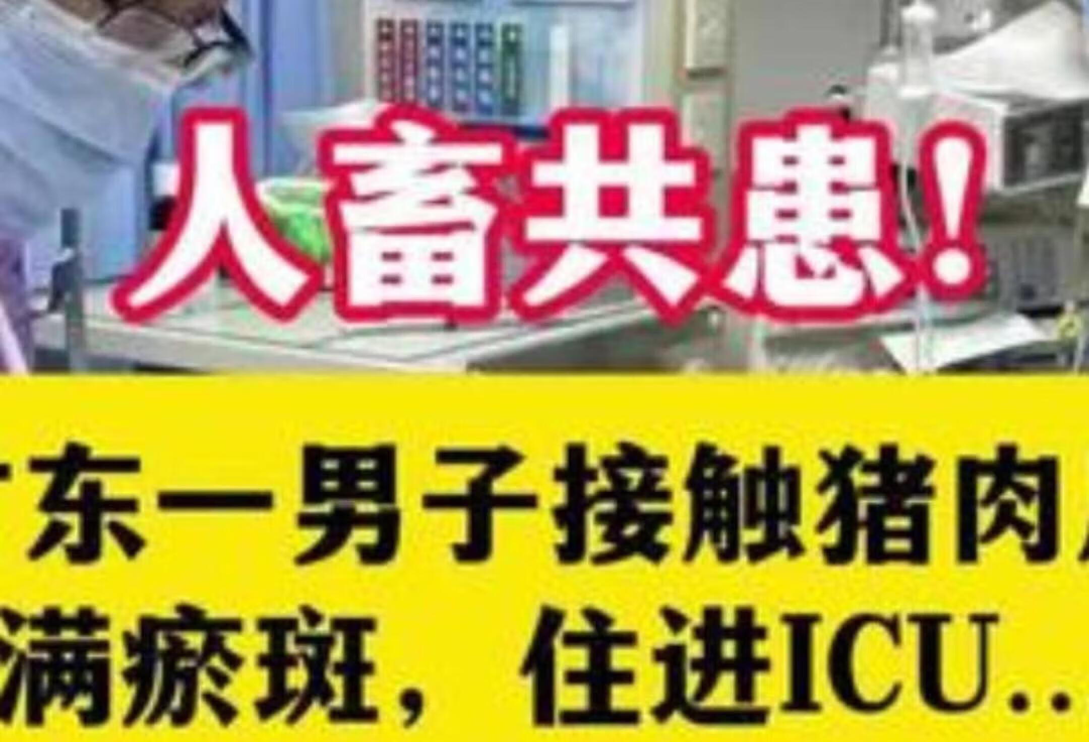 广东男子接触猪肉后长满瘀斑，紧急住ICU