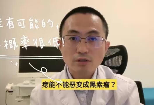 痣会恶变成黑素瘤吗？是有可能的，但概率很低，别担心 