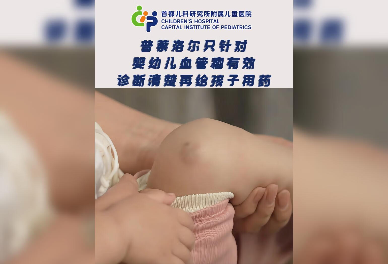 普萘洛尔只针对 婴幼儿血管瘤有效 诊断清楚再给孩子用药 