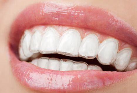 牙齿矫正内收过多原因有哪些？