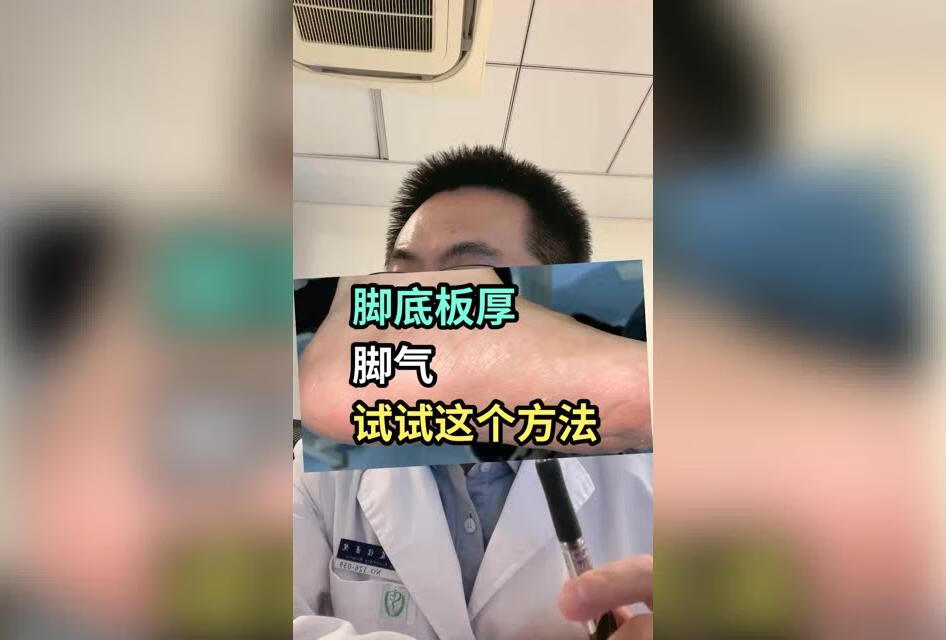 脚底板厚脱皮还痒的脚气，试试这个方法 