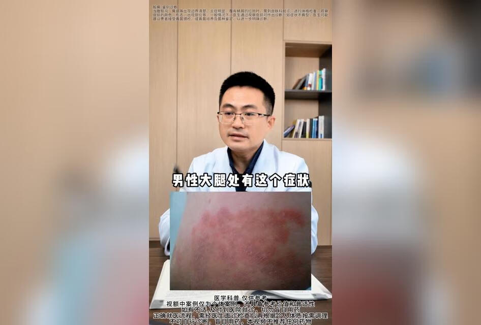 男性大腿根有这个症状，很容易传染给爱人 