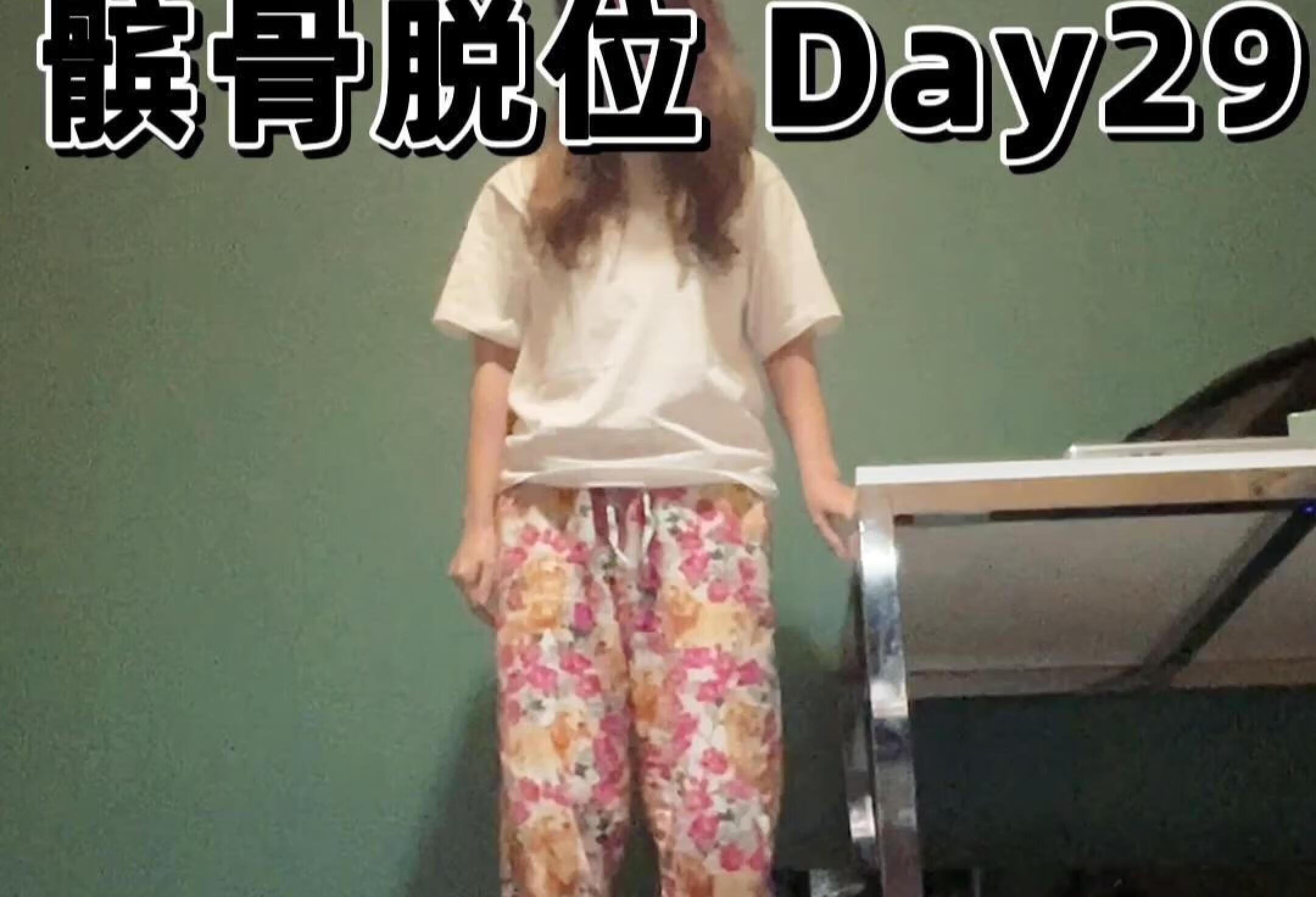 髌骨脱位Day29（复建ing