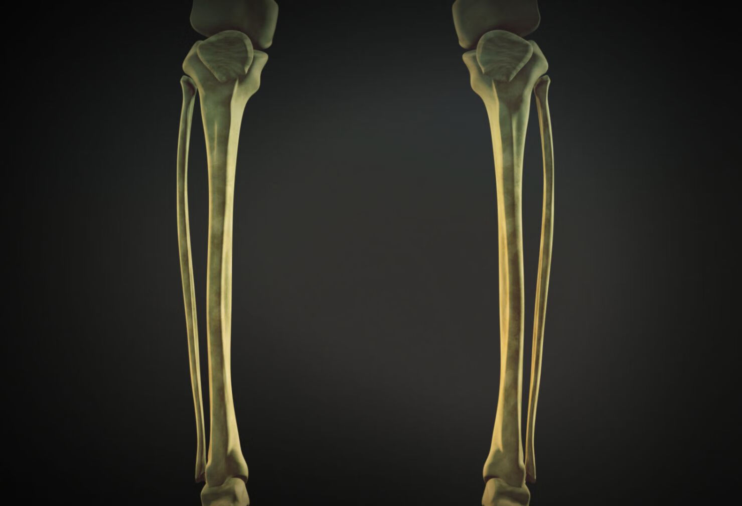 肱骨外髁骨折有什么症状？