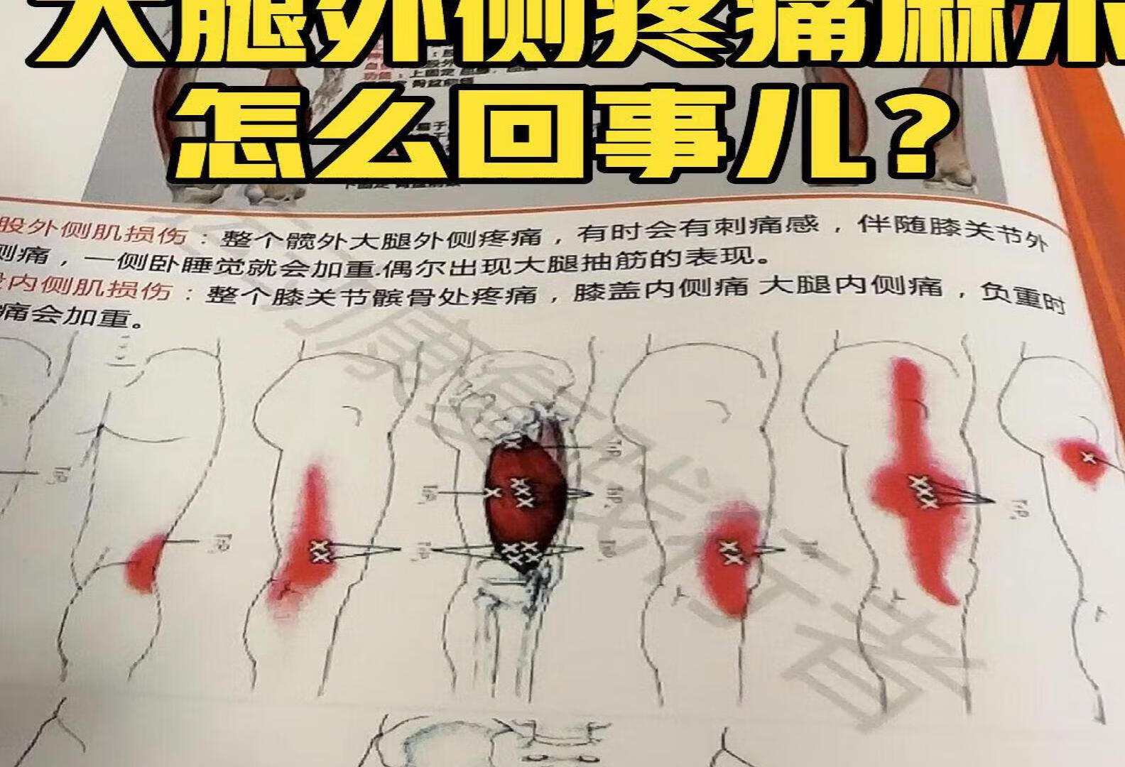 大腿外侧疼 刺痛 怎么回事儿？