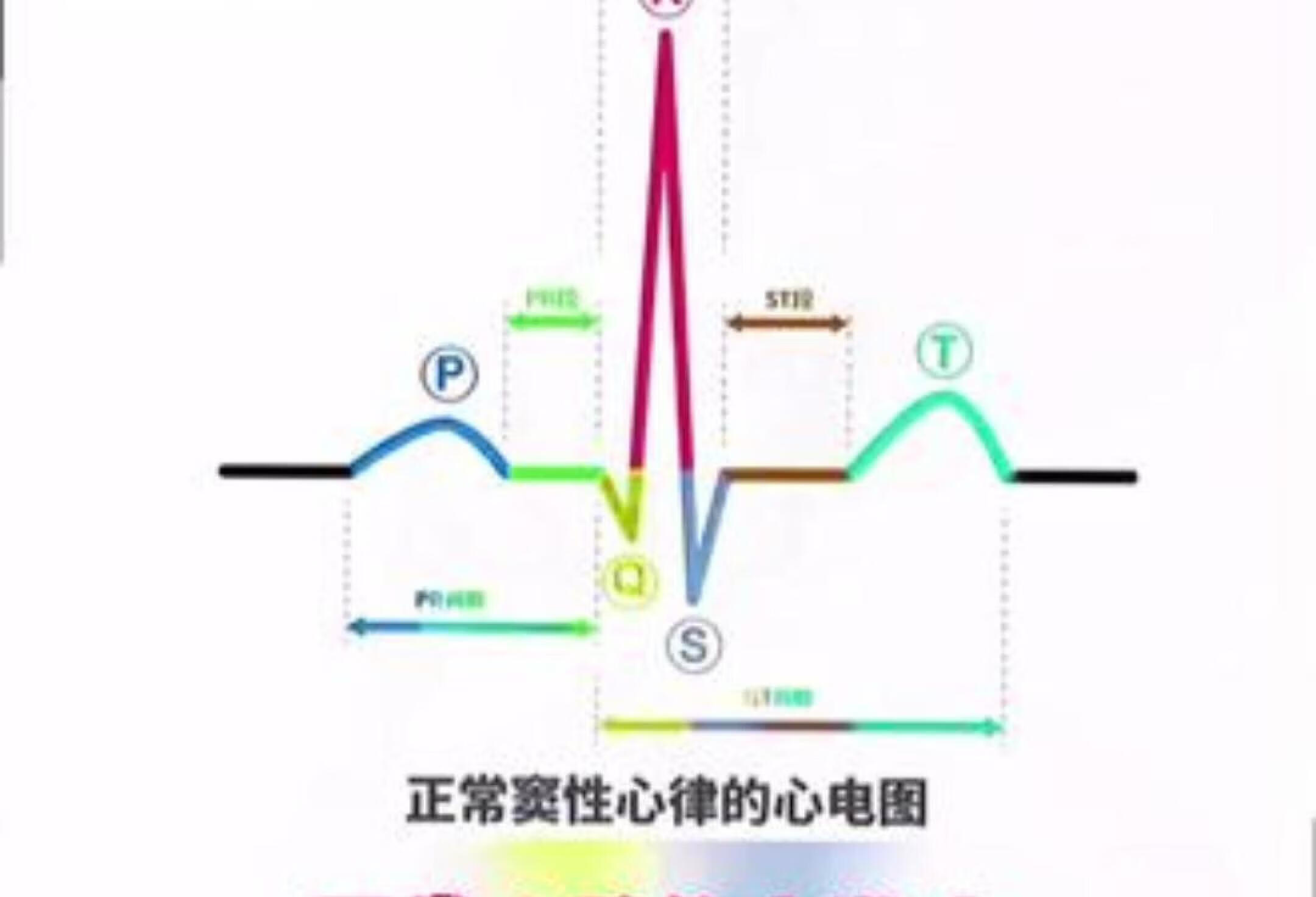 一分钟带你搞懂心电图，零基础也能秒懂！心电图动画