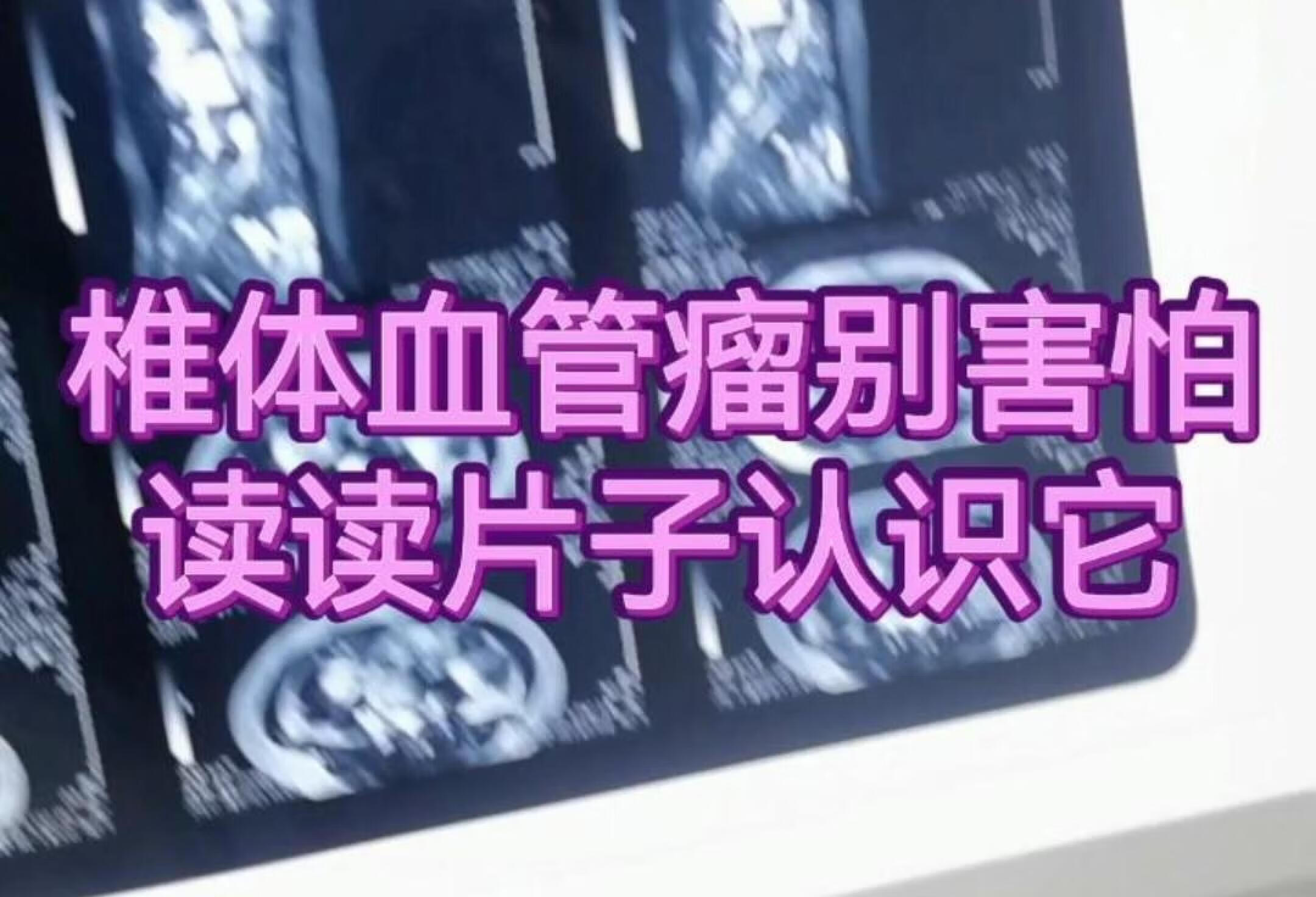 椎体血管瘤别害怕，读读片子认识它