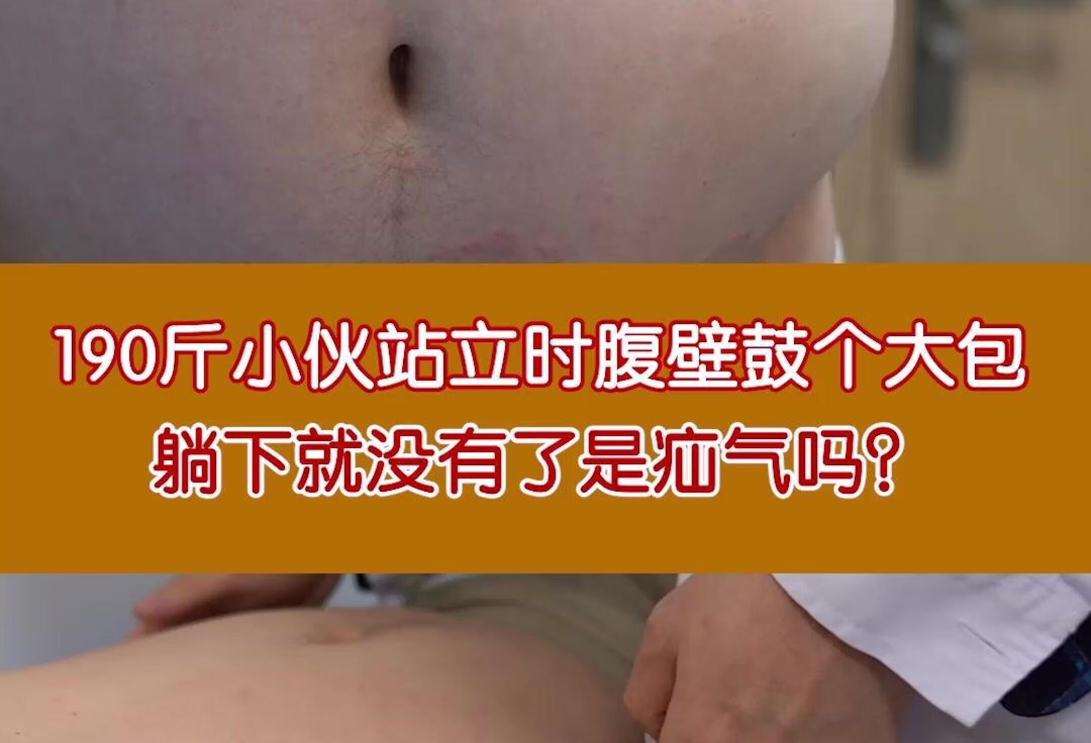 190斤小伙站立时腹壁鼓个大包，是疝气吗？