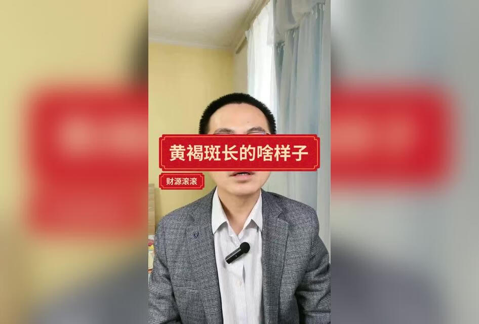 黄褐斑到底长的是什么样子呢？ 