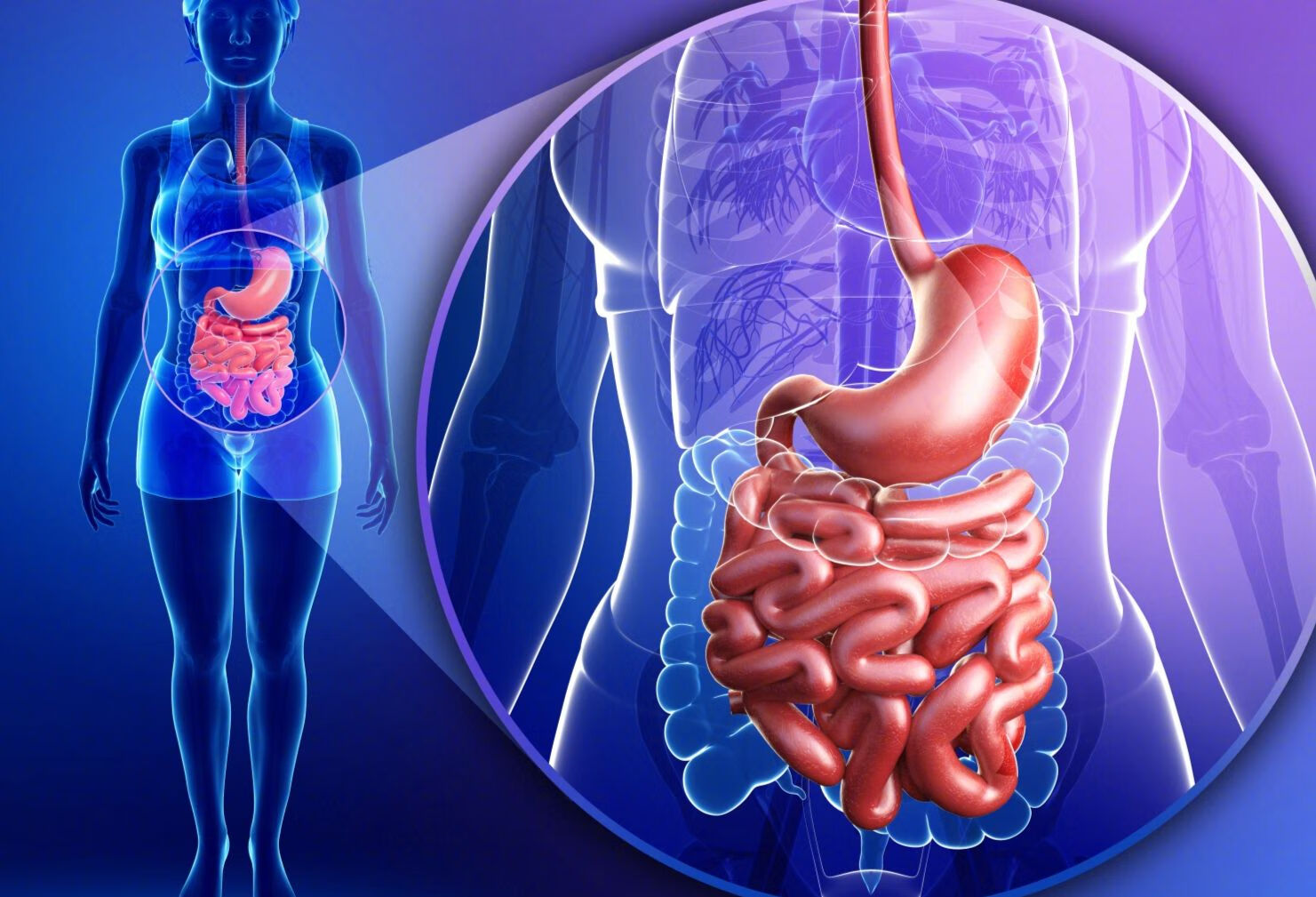 肠结石典型症状有哪些？