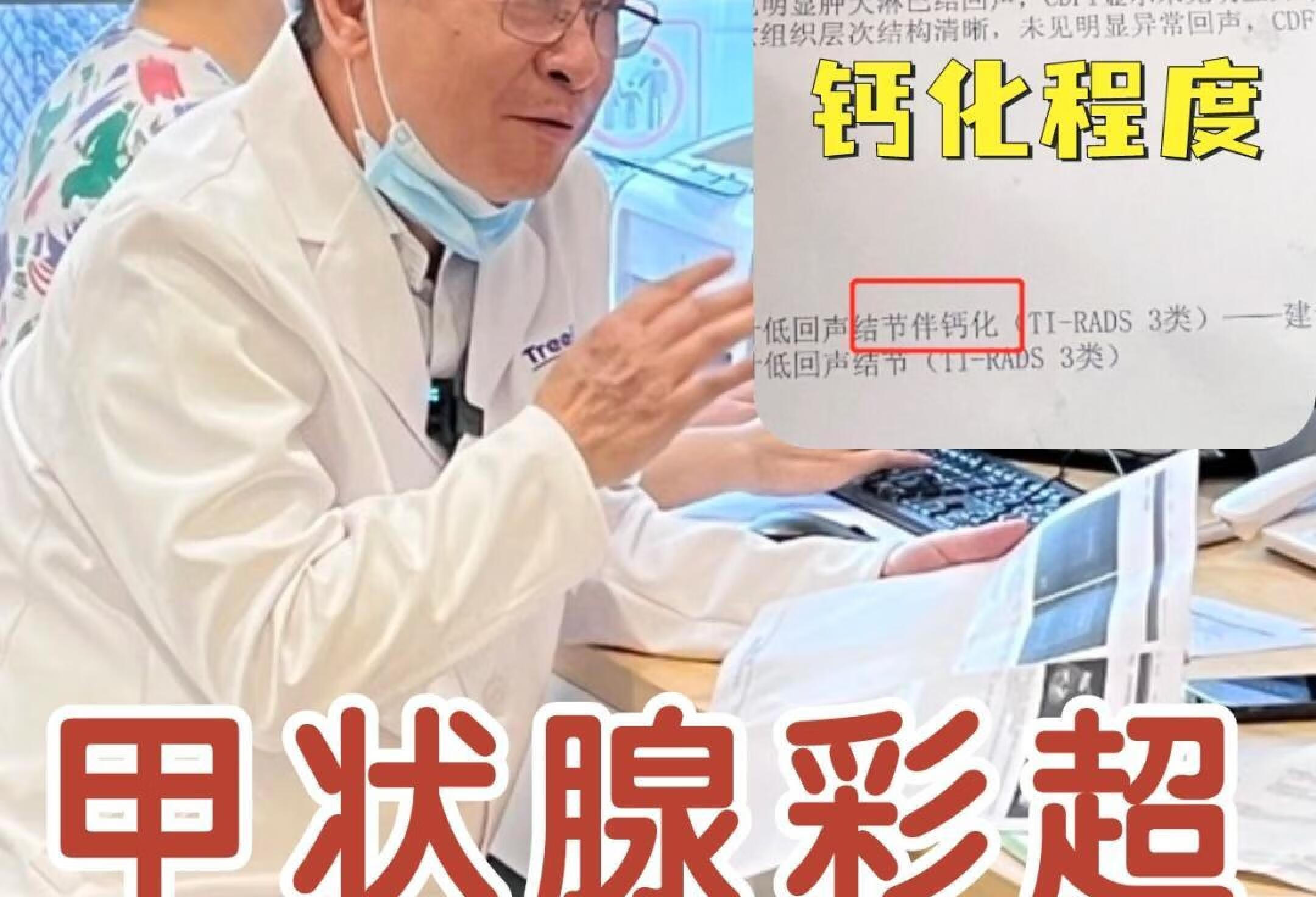 看懂甲状腺体检单4:甲状腺钙化程度