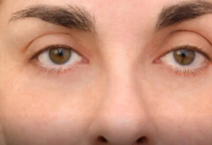 眼睛经常痒可能是过敏体质吗？