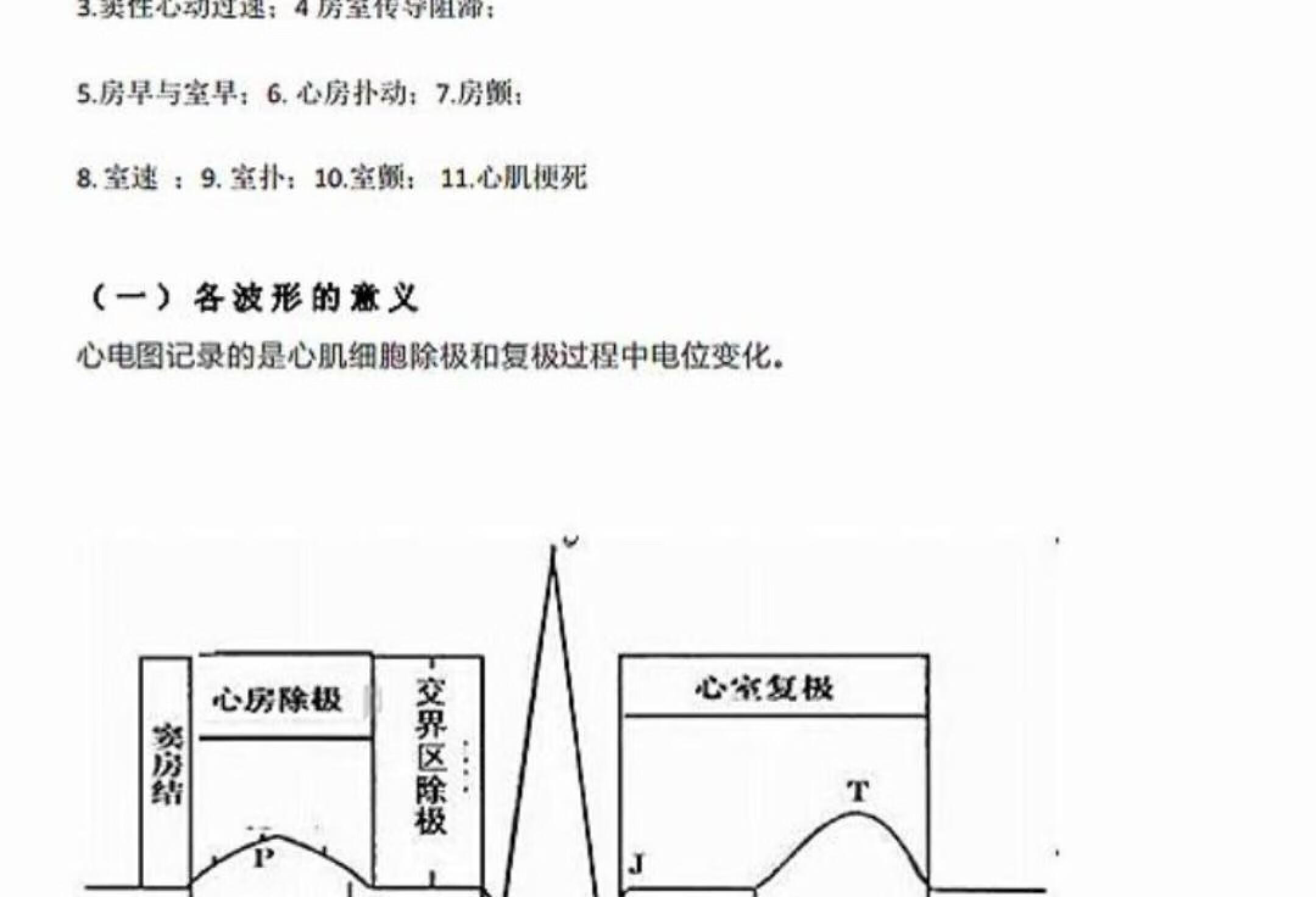 心电图大全！几秒钟就让你全部会了，收藏