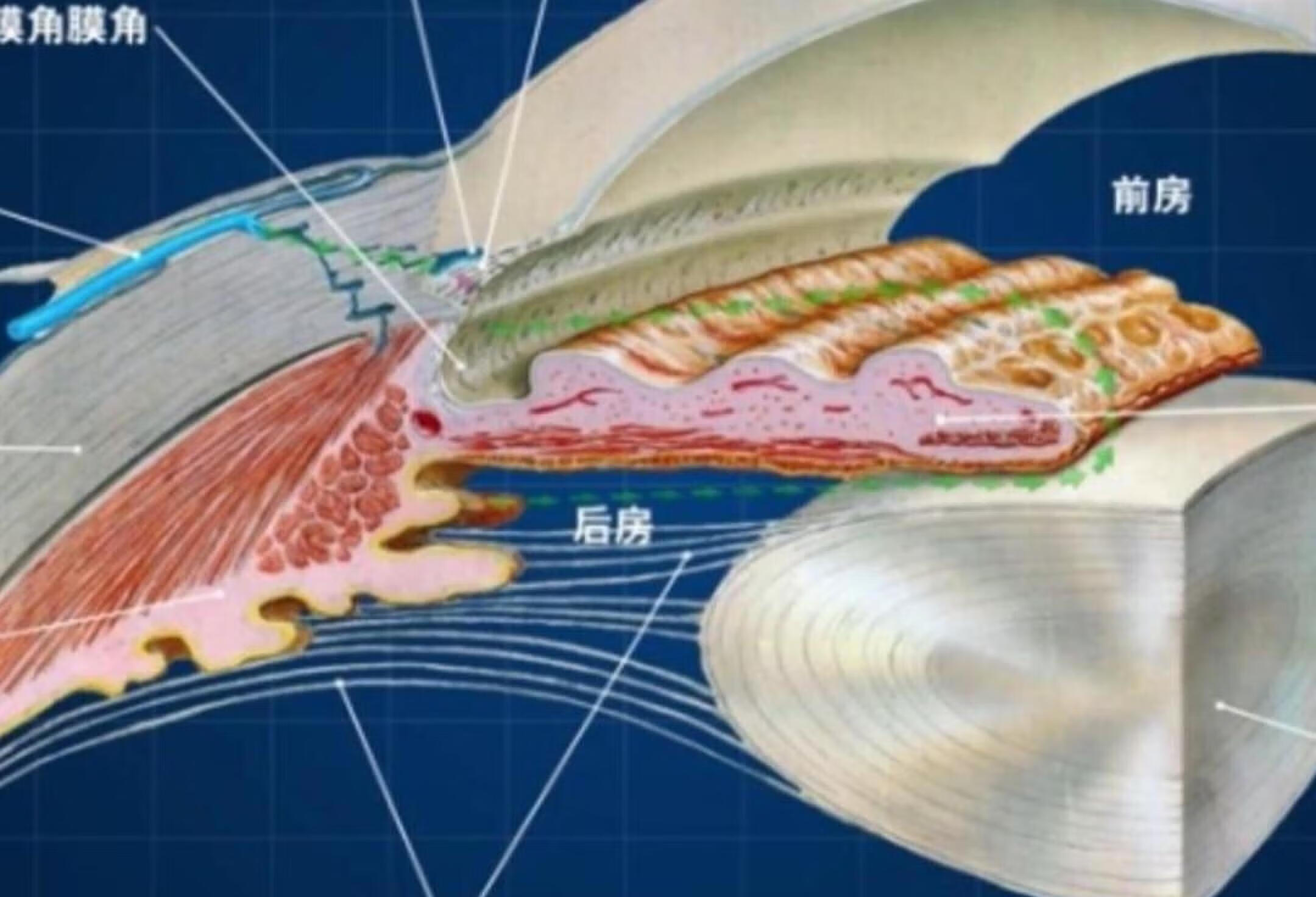 从解剖学的角度，带您了解青光眼的发生机制