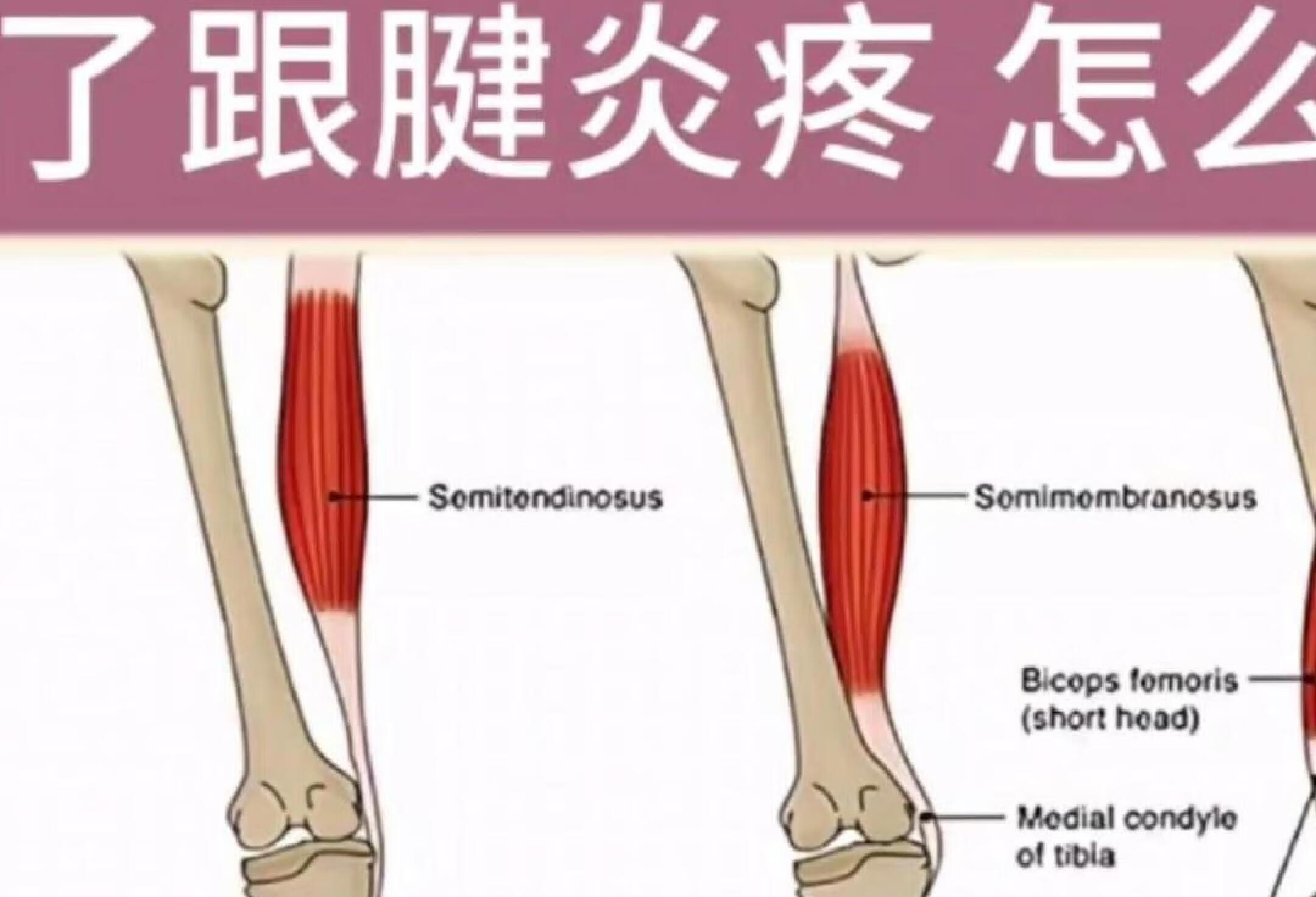 跟腱知识了解和改善攻略，务必收藏