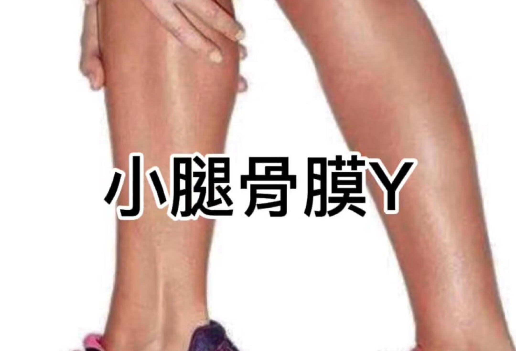 小腿骨膜Y