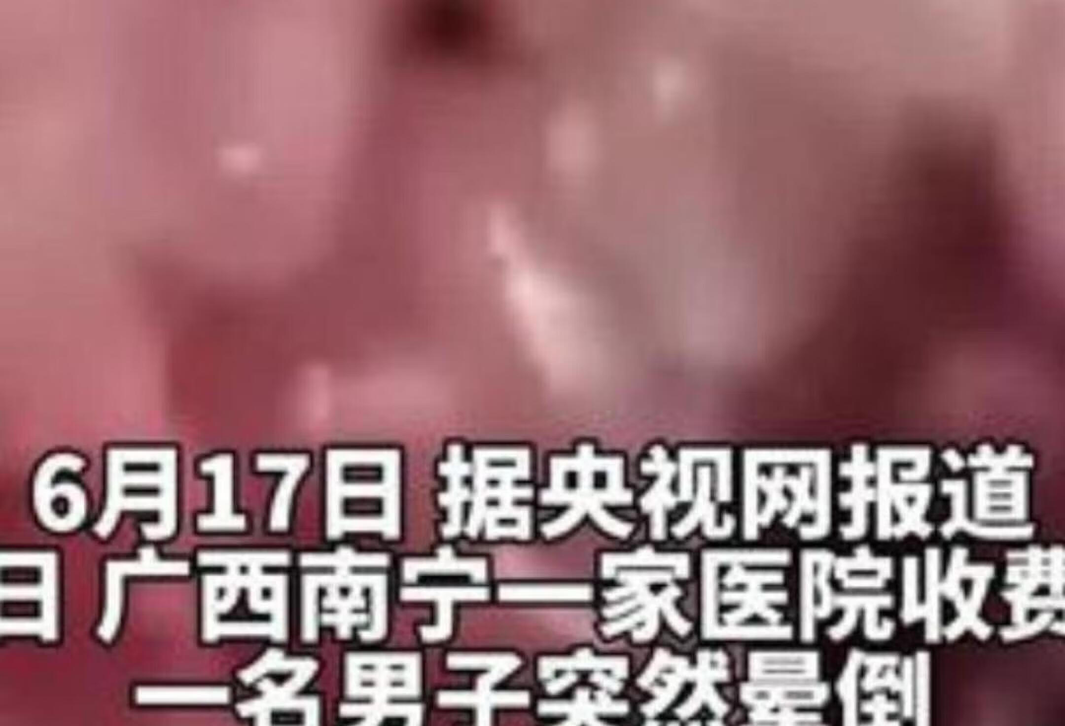 男子吃生猪肉突发脑囊虫病癫痫 医生提醒：生肉生海鲜要慎重