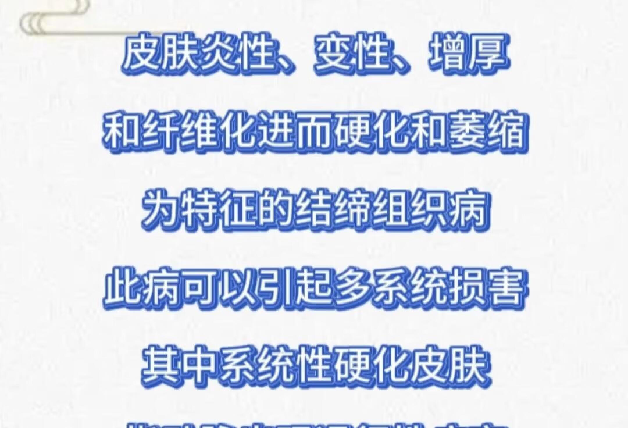 结缔组织病