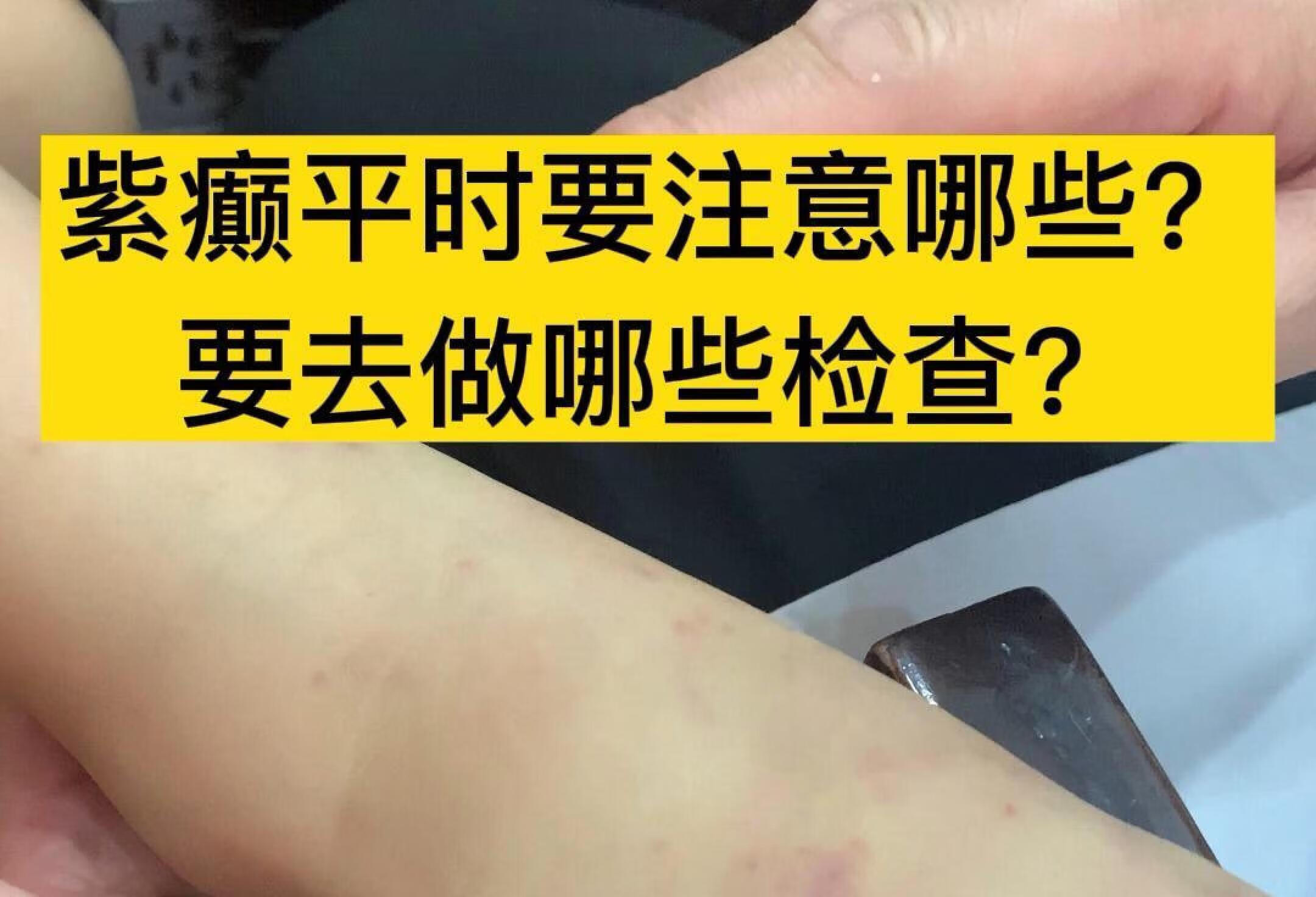 孩子身上出现紫色小斑点？一定要引起重视！