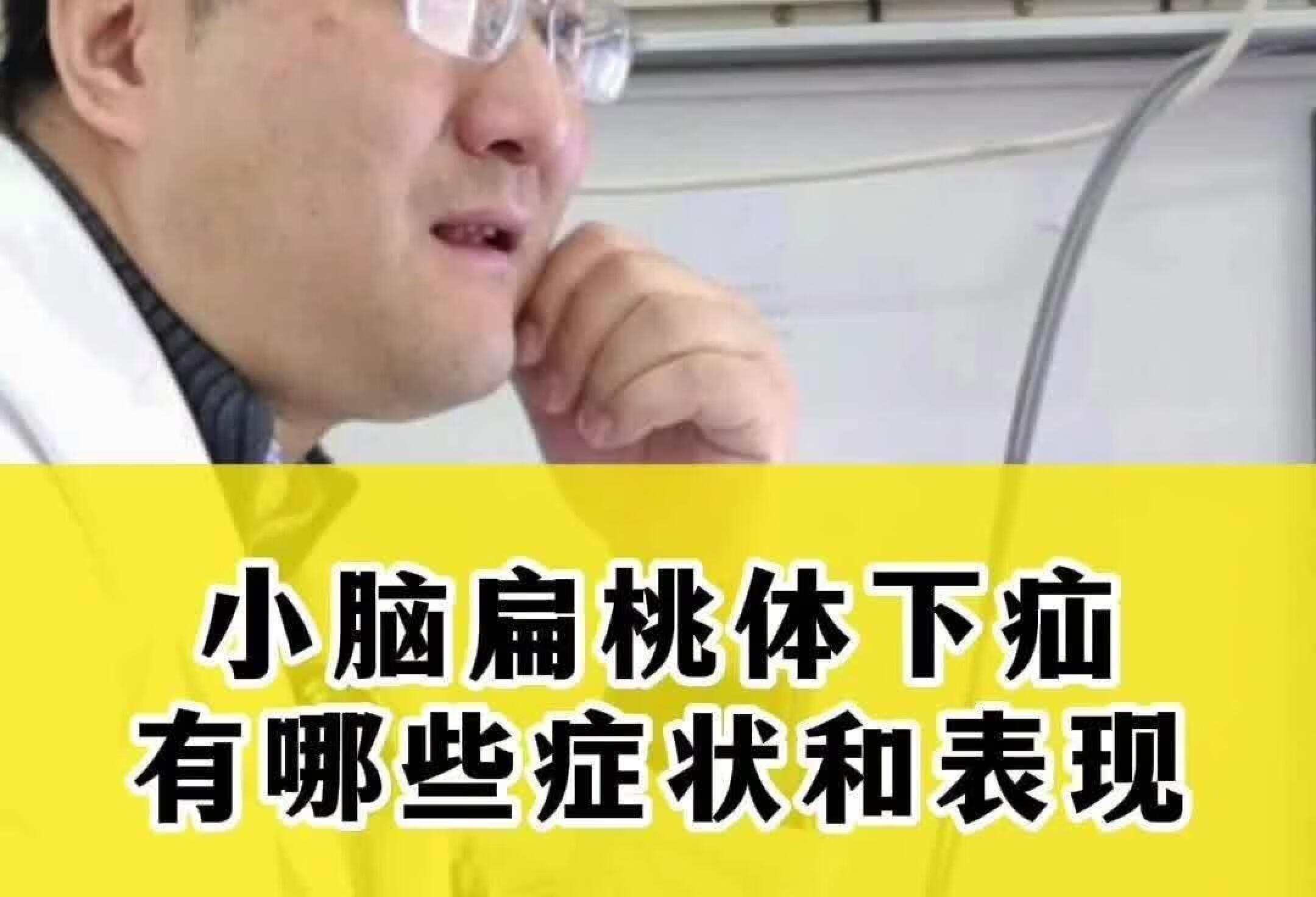 小脑扁桃体下疝有哪些症状和表现