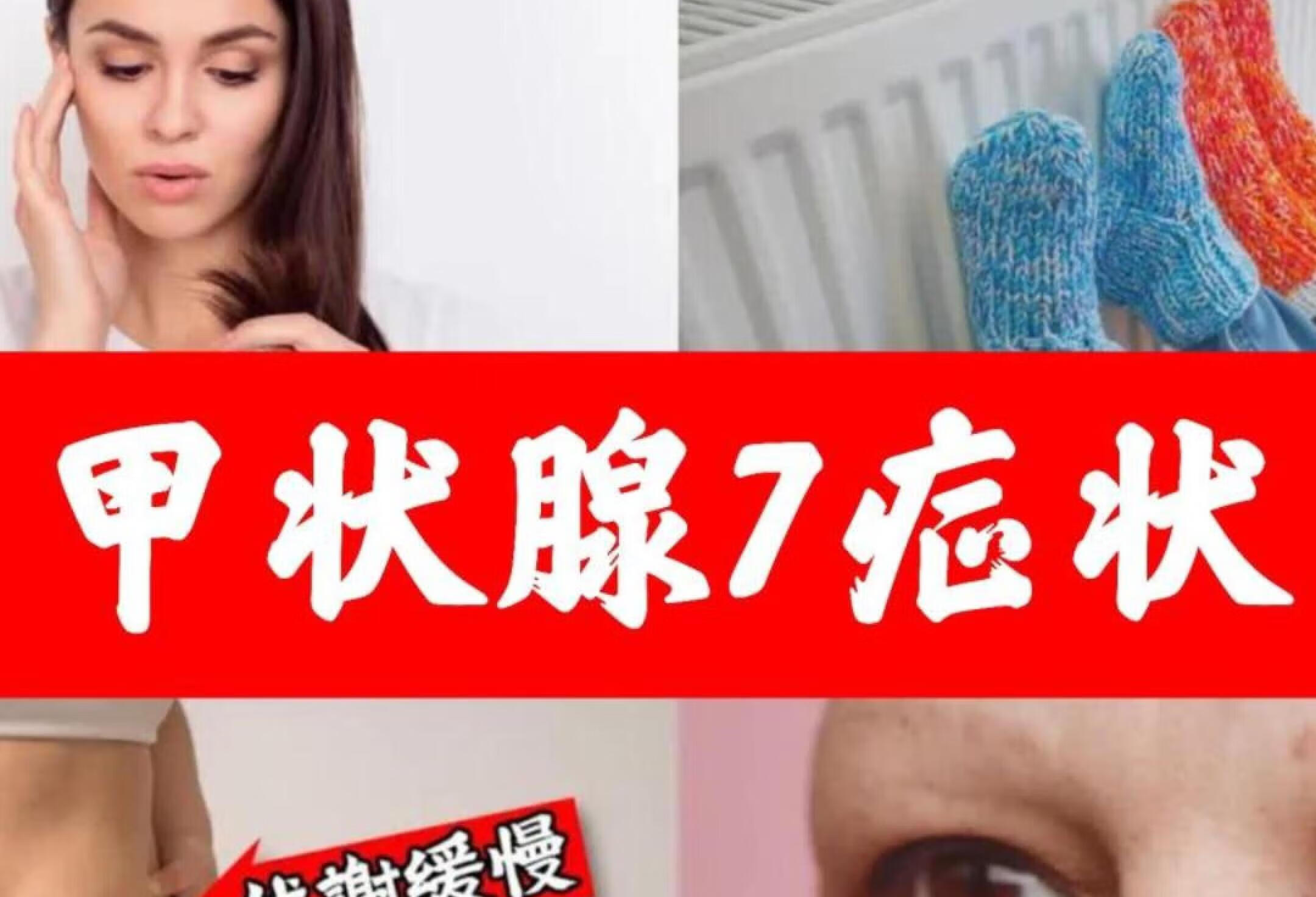 甲状腺早期7个症状,自然疗法,伯格医生