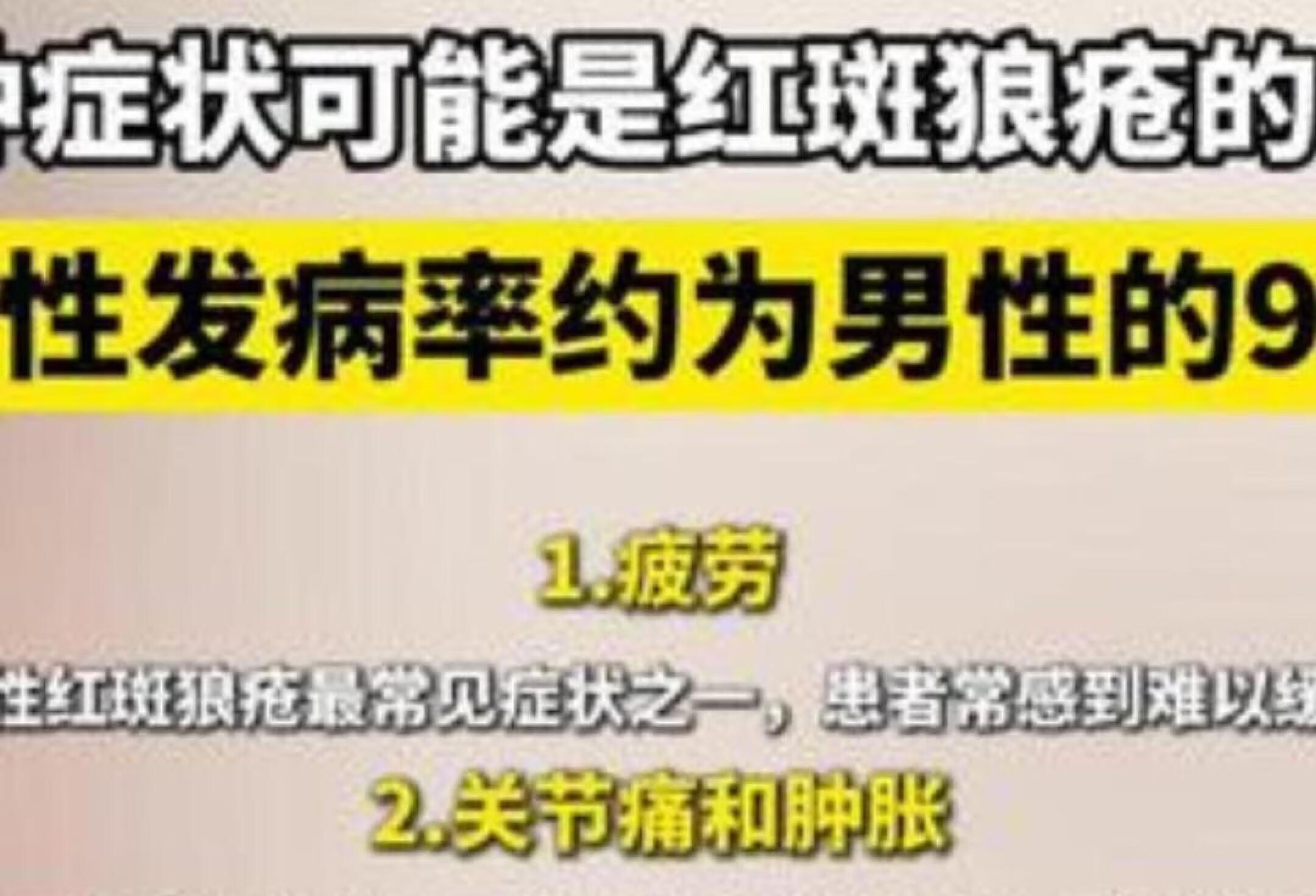 红斑狼疮10大症状，女性患病率高9倍