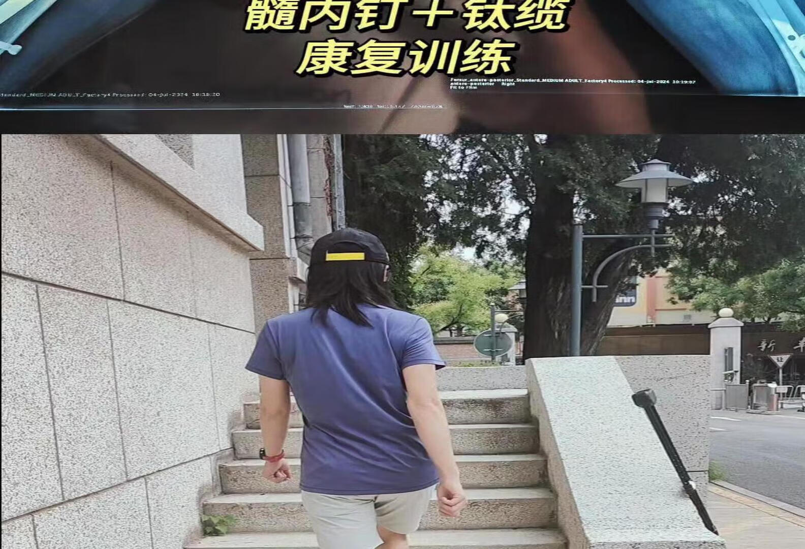 个人训练记录，请遵医嘱